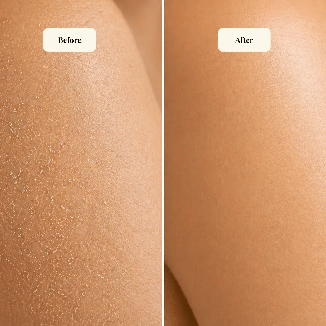 Nourishing Body Butter for Sensitive Skin
