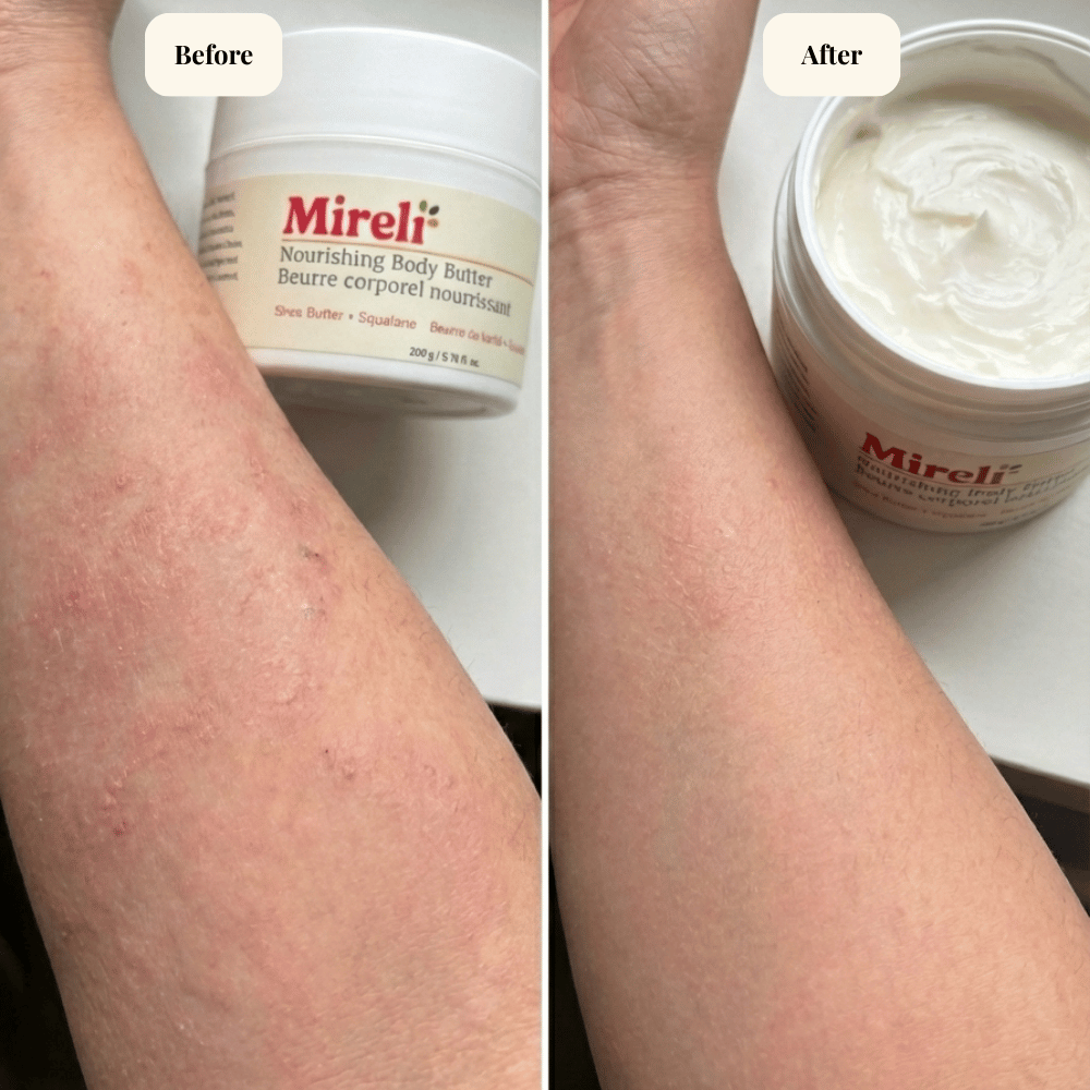 Nourishing Body Butter for Sensitive Skin