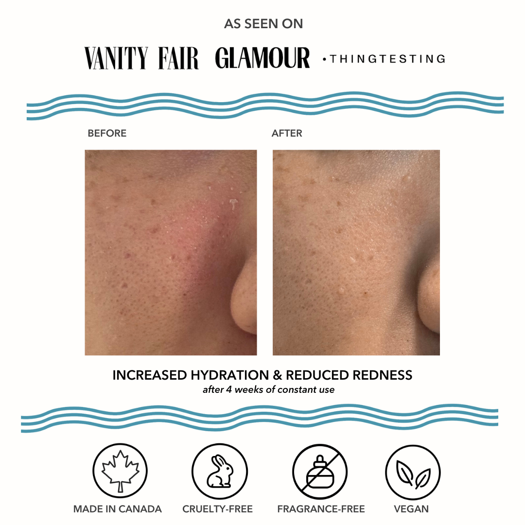 Skin Redness Recovery Overnight Moisturizer