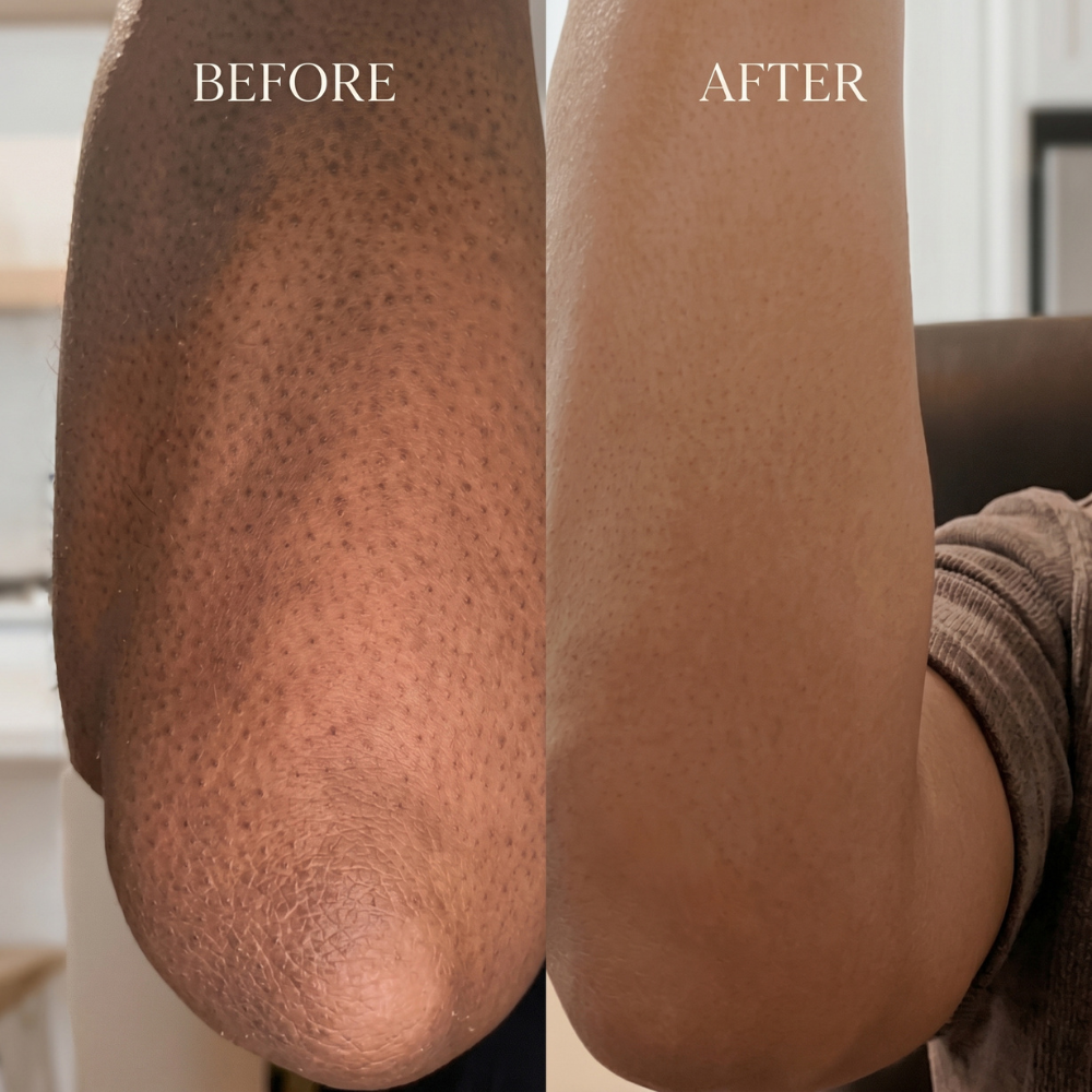 Nourishing Body Butter for Sensitive Skin